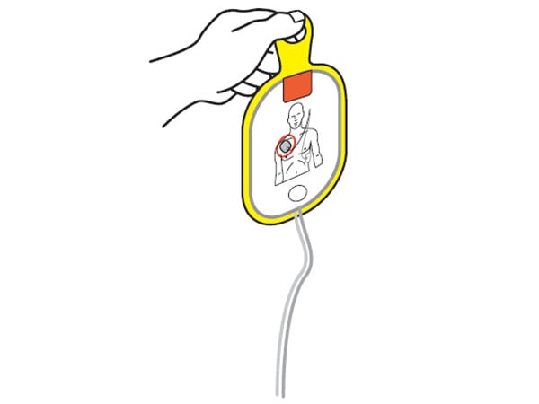【STEP2】パッド（電極）を貼ります パッドを貼る位置は、パッドやパッドの入っている袋に書かれています。 傷病者の胸をはだけ、裸になった胸に直接パッドを貼ります。 傷病者の肌にしっかり密着させないと、ＡＥＤから電気がうまく伝わりません。