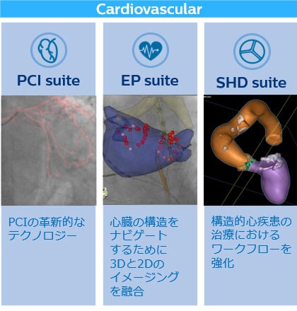 最新のアプリケーション Cardiovascular
