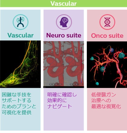 最新のアプリケーション Vascular