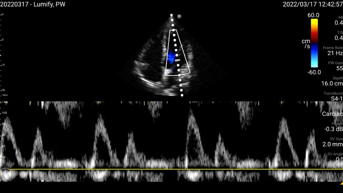 pulse doppler