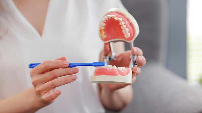 丁寧なブラッシングが虫歯予防の基本