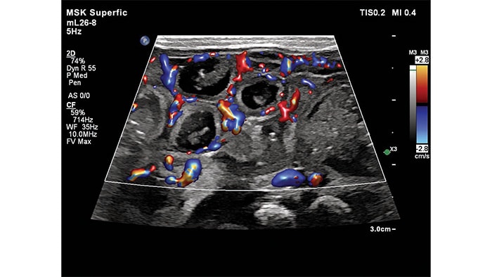 ml26 8 flow viewer