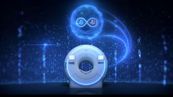 AI技術によりMRIのさらなる高速化と高画質化を革新、「SmartSpeed Precise」登場