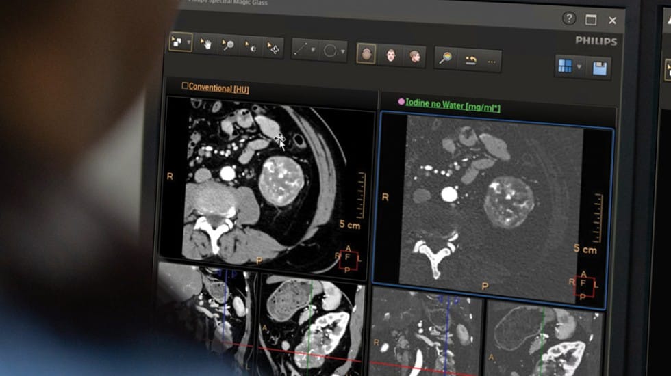AI-Powered Multi-Energy Spectral CT Scanner